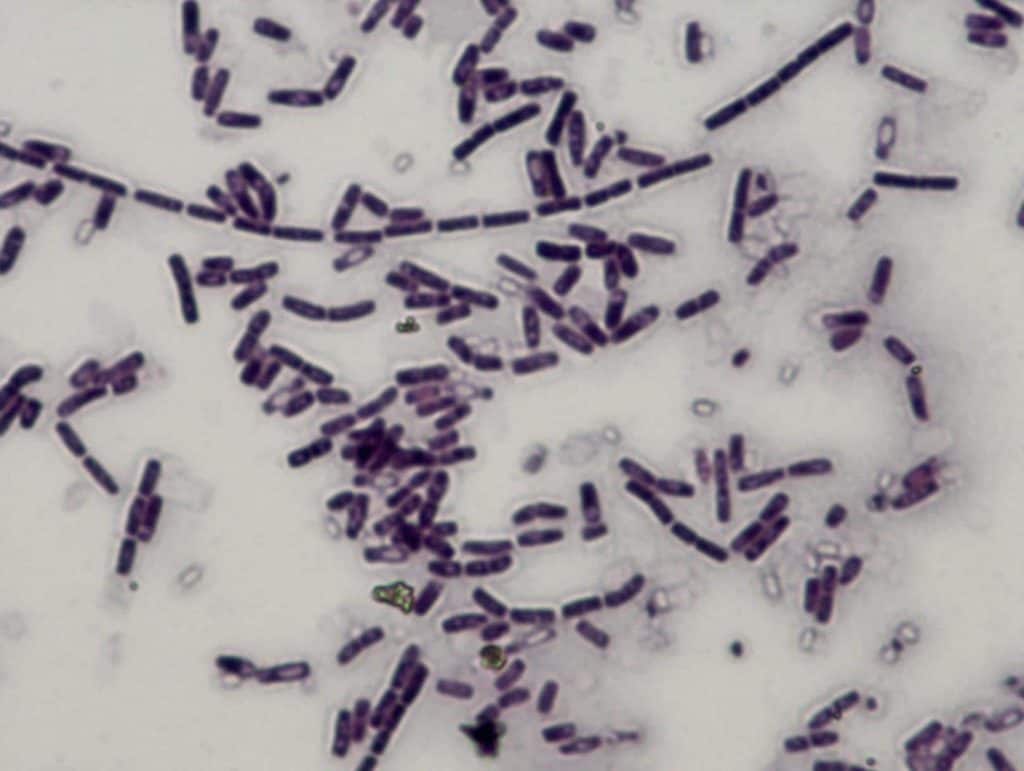 Gambar gram positif Bacillus cereus