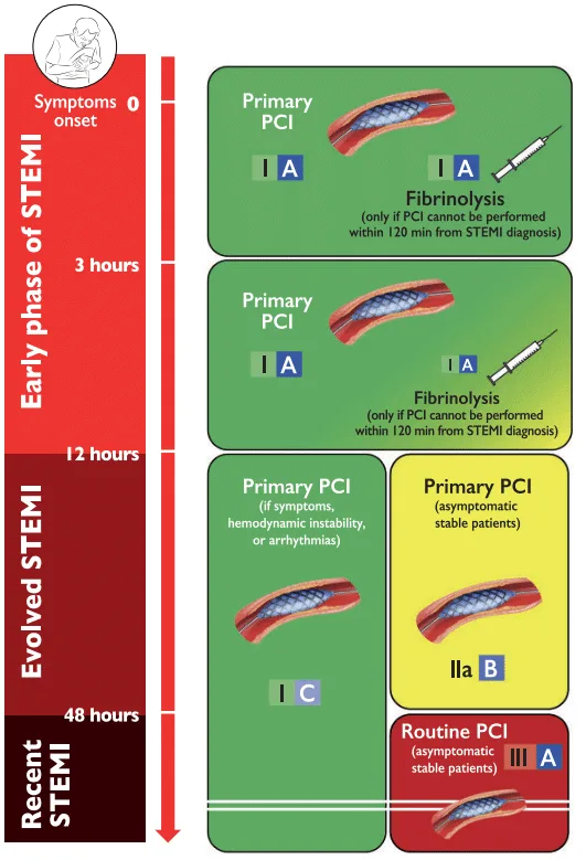 Indikasi primary PCI dengan memperhatikan onset kejadian STEMI