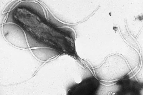 Flagella dari H. pylori
