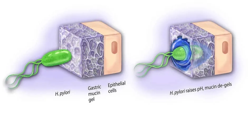Mekanisme H. pylori menggunakan amonia untuk menembuas lapisa muscin gaster