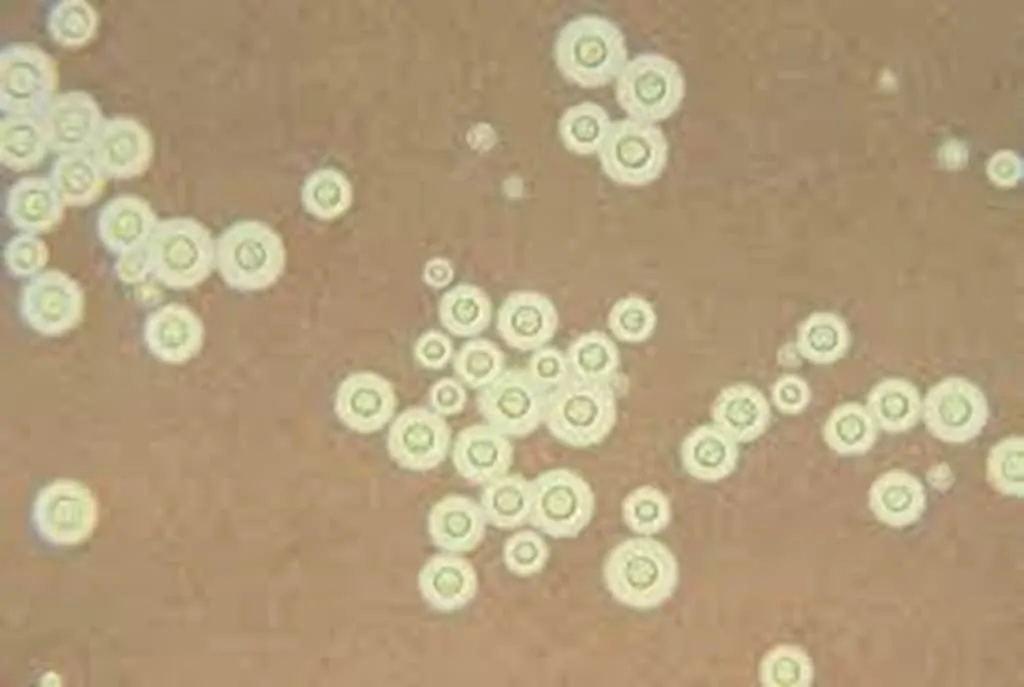 Criptococcus dengan gambaran halo.