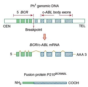 Fusi gen BCR dengan gen ABL menghasilkan protein Bcr-Abl