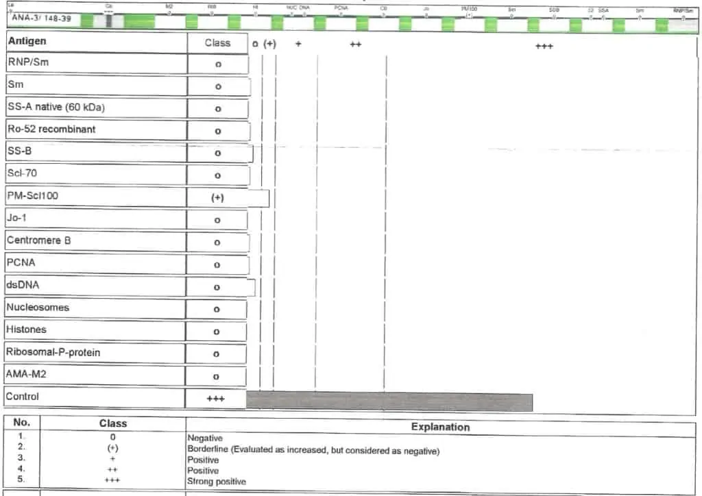 Contoh pemeriksaan ANA profile dengan metode ELISA