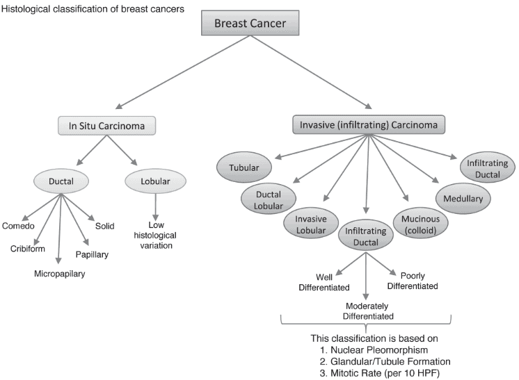 Bagan pembagian jenis kanker payudara berdasarkan gambaran histopatologi