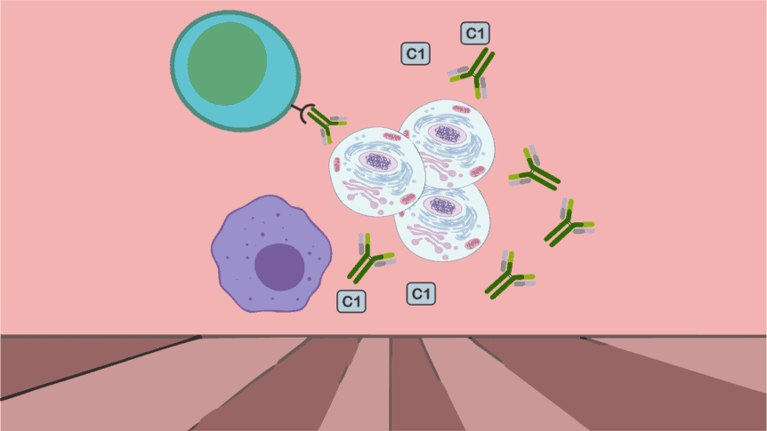 Patogenesis Dan Patofisiologi Sle Systemic Lupus Erythematosis Kedokteran Caiherang