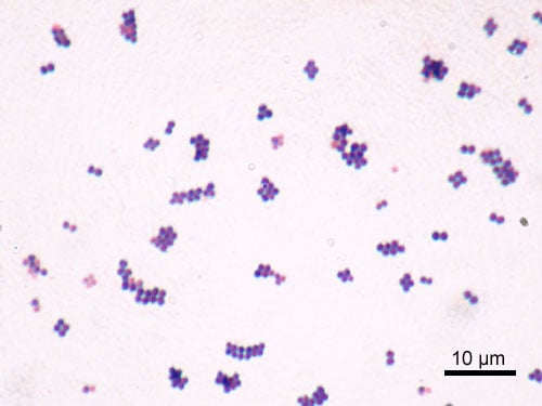 Gambar gram positif Staphylococcus aureus. Gambar oleh Y Tambe, CC BY-SA 3.0, Link