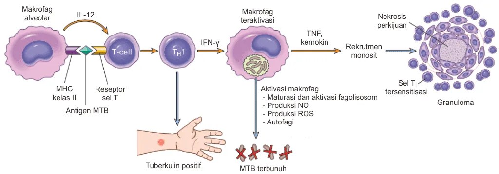 Aktivasi sistem imunitas pada tuberkulosis