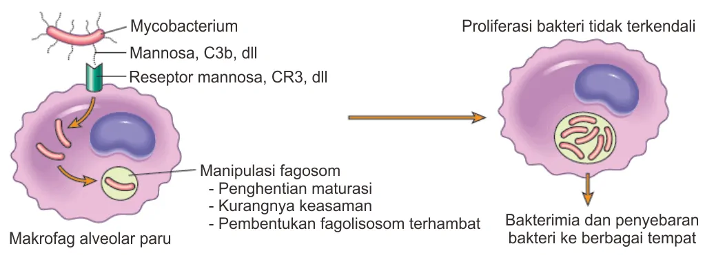 Infeksi tuberkulosis sebelum aktivasis sistem imunitaas tubuh