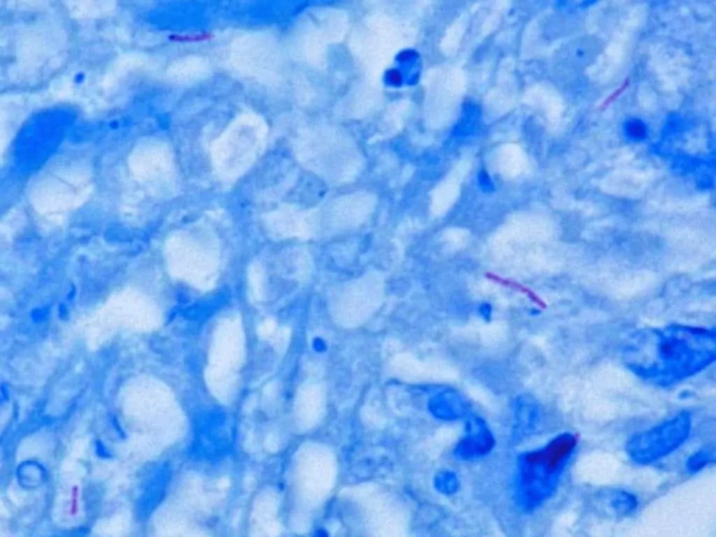 Bentuk batang Mycobacterium tuberculosis