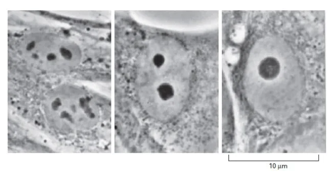Gambar nukleolus fibroblas dalam beberapa fase
