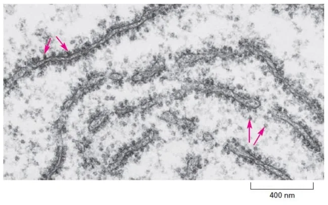 Ribosom di sel eukariota