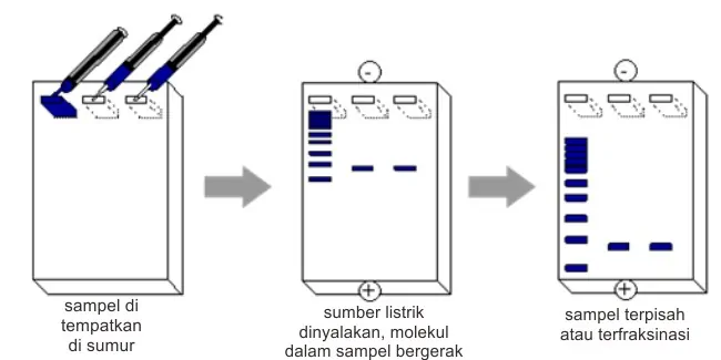 Bagan cara pemeriksaan elektroforesa