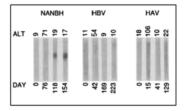 Pemeriksaaan iminoblot serum terhadap ORF 5-1-1 secara serial terhadap simpanse yang terinfeksi HNANB, HAV dan HBV
